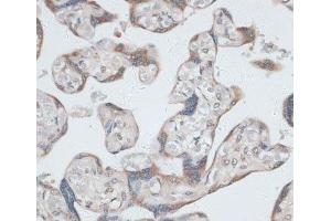 Immunohistochemistry of paraffin-embedded Human placenta using KRT7 Polyclonal Antibody at dilution of 1:100 (40x lens). (Cytokeratin 7 Antikörper)