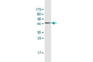 Western Blotting (WB) image for anti-Ribonucleotide Reductase M1 (RRM1) (AA 593-792) antibody (ABIN950037)