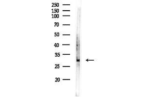anti-Carbonic Anhydrase VA (CA5A) (Internal Region) antibody