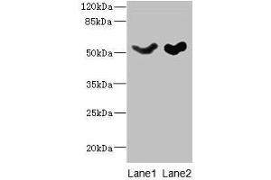 Western blot All lanes: SLC25A25 antibody at 10 μg/mL Lane 1: Mouse liver tissue Lane 2: Mouse brain tissue Secondary Goat polyclonal to rabbit IgG at 1/10000 dilution Predicted band size: 53, 56, 57, 55, 41 kDa Observed band size: 53 kDa