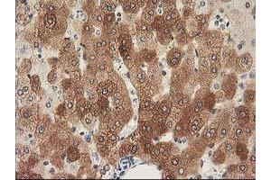 Image no. 12 for anti-Nonhomologous End-Joining Factor 1 (NHEJ1) antibody (ABIN1499729) (NHEJ1 Antikörper)