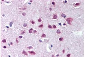 Human Brain, Cortex (formalin-fixed, paraffin-embedded) stained with UBA6 antibody ABIN290255 at 10 ug/ml followed by biotinylated goat anti-rabbit IgG secondary antibody ABIN481713, alkaline phosphatase-streptavidin and chromogen. (UBA6 Antikörper  (AA 300-350))