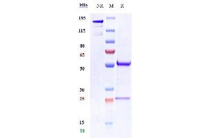 Anti-CDH11 / Cadherin-11 Reference Antibody (RG6125) on SDS-PAGE under reducing (R) condition.