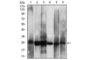 Western blot analysis using CSNK2B mouse mAb against Hela (1), Jurkat (2), C6 (3), MCF-7 (4), SK-N-SH (5), NTERA-2 (6) cell lysate.