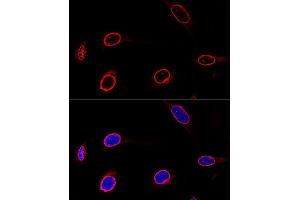 Confocal immunofluorescence analysis of U-2 OS cells using Emerin/Emerin/EMD Polyclonal Antibody  at dilution of 1:100. (Emerin Antikörper  (AA 1-220))