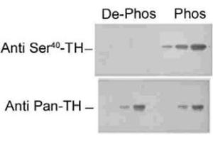 Western blot of recombinant phospho- and dephospho-Th showing selective immunolabeling by the phospho-specific antibody of the ~60k Th phosphorylated at Ser40. (Tyrosine Hydroxylase Antikörper)