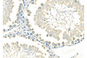 ABIN6265844 and ABIN6276978 at 1/100 staining Rat testis tissue by IHC-P. (UBE2D1 Antikörper  (C-Term))