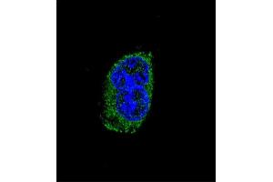 Confocal immunofluorescent analysis of TSHB Antibody (Center) (ABIN652558 and ABIN2842375) with MDA-M cell followed by Alexa Fluor® 488-conjugated goat anti-rabbit lgG (green). (TSHB Antikörper  (AA 58-86))