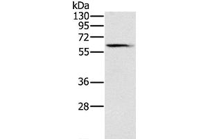 Western Blot analysis of Human fetal brain tissue using SLC45A3 Polyclonal Antibody at dilution of 1:200 (SLC45A3 Antikörper)
