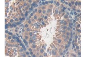 Immunohistochemistry (IHC) image for anti-Protein tyrosine Phosphatase, Receptor Type, J (PTPRJ) (AA 567-842) antibody (ABIN7441778)
