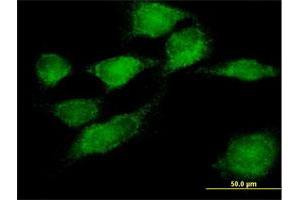 Immunofluorescence of purified MaxPab antibody to SNX11 on HeLa cell. (SNX11 Antikörper  (AA 1-270))