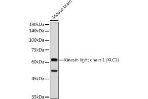 Western blot analysis of extracts of Mouse brain, using Kinesin light chain 1 (Kinesin light chain 1 (KLC1)) antibody (ABIN7268139) at 1:1000 dilution. (KLC1 Antikörper)