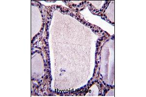 Immunohistochemistry (Paraffin-embedded Sections) (IHC (p)) image for anti-Neutral Sphingomyelinase (N-SMase) Activation Associated Factor (NSMAF) (AA 28-57), (N-Term) antibody (ABIN657508)