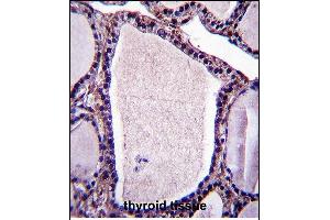 NSF Antibody (N-term) (ABIN657508 and ABIN2846532) immunohistochemistry analysis in forlin fixed and paraffin embedded hun thyroid tissue followed by peroxidase conjugation of the secondary antibody and DAB staining.