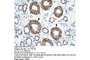 Human kidney (TRIM13 Antikörper  (Middle Region))