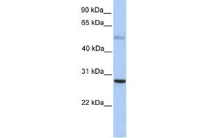 Western Blotting (WB) image for anti-MAX Dimerization Protein 1 (MXD1) antibody (ABIN2458296) (MXD1 Antikörper)