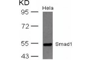 Image no. 2 for anti-SMAD, Mothers Against DPP Homolog 1 (SMAD1) (AA 461-465) antibody (ABIN319351) (SMAD1 Antikörper  (AA 461-465))
