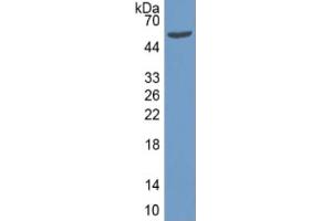 Western Blotting (WB) image for Keratin 15 (KRT15) ELISA Kit (ABIN6574162)