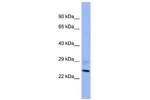 PPM1B antibody used at 1 ug/ml to detect target protein. (PPM1B Antikörper)
