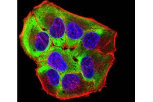 Immunofluorescence analysis of Hela cells using ROP1 mouse mAb (green).