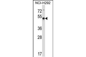 Western blot analysis in NCI-H292 cell line lysates (35ug/lane). (ACTR6 Antikörper  (C-Term))