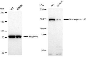 Western blotting analysis using Nucleoporin 155 antibody (ABIN7799675). (Rekombinanter NUP155 Antikörper)