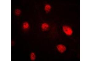 Immunofluorescent analysis of Pr-Set7 staining in MCF7 cells. (SETD8 Antikörper)