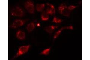 ABIN6275913 staining Hela cells by IF/ICC. (Adenosine A2a Receptor Antikörper  (Internal Region))