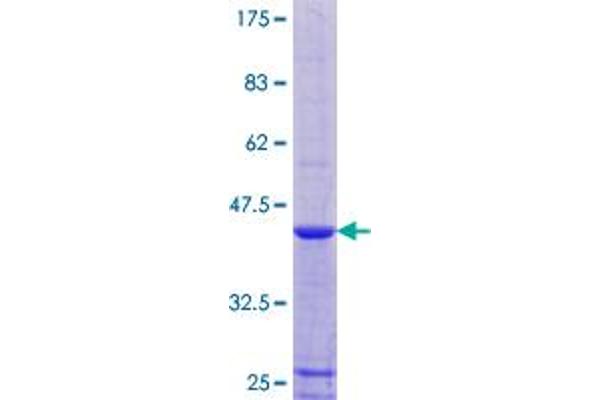 RPLP1 Protein (AA 1-114) (GST tag)