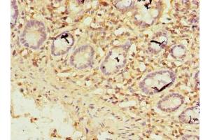 Immunohistochemistry of paraffin-embedded human small intestine tissue using ABIN7176140 at dilution of 1:100 (ZNF19 Antikörper  (AA 1-200))