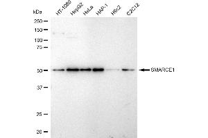 Western blotting analysis using SMARCE1 antibody (ABIN7800481).