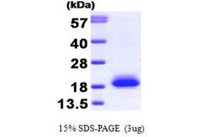 SDS-PAGE (SDS) image for Visinin-Like 1 (VSNL1) (AA 1-191) protein (ABIN666662) (VSNL1 Protein (AA 1-191))