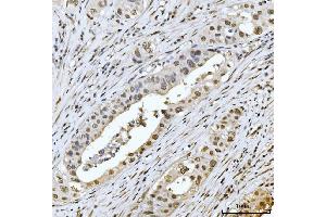 IHC analysis of MRE11 using anti-MRE11 antibody (ABIN7600025). (Mre11 Antikörper  (AA 14-481))