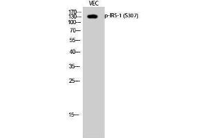 Western Blotting (WB) image for anti-Insulin Receptor Substrate 1 (IRS1) (pSer307) antibody (ABIN3182046) (IRS1 Antikörper  (pSer307))
