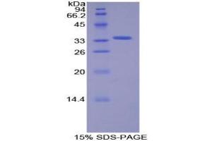 SDS-PAGE analysis of Human SIK2 Protein. (SIK2 Protein)