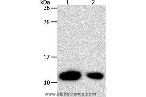 Western blot analysis of Hela cell and human liver cancer tissue, using TXN Polyclonal Antibody at dilution of 1:700 (TXN Antikörper)
