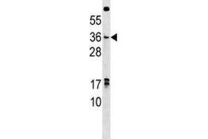 Western Blotting (WB) image for anti-NK3 Homeobox 1 (NKX3-1) (AA 3-1) antibody (ABIN3028874)