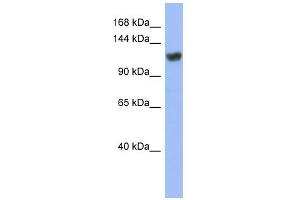 WB Suggested Anti-ZNF423 Antibody Titration:  0.