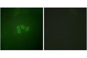 Immunofluorescence analysis of A549 cells, using eIF4B (Ab-422) Antibody. (EIF4B Antikörper  (AA 388-437))