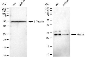 Western blotting analysis using Hsp22 antibody (ABIN7798842). (Rekombinanter HSPB8 Antikörper)