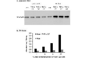 Activity Assay (AcA) image for Nuclear Factor-kB p65 (NFkBP65) ELISA Kit (ABIN4889784)