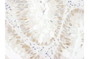 Immunohistochemistry (IHC) image for anti-BRCA2 and CDKN1A Interacting Protein (BCCIP) (AA 300-350) antibody (ABIN7448933) (BCCIP Antikörper  (AA 300-350))
