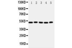 Western Blotting (WB) image for anti-Aldehyde Dehydrogenase 3 Family, Member A1 (ALDH3A1) (AA 440-453), (C-Term) antibody (ABIN3042917)