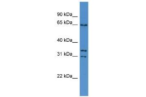 WB Suggested Anti-Cpne5 Antibody Titration: 0.