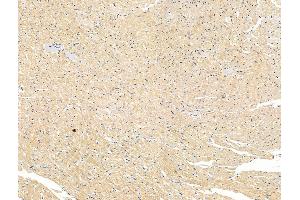 ABIN7094628 and ABIN7098678 at 1/100 staining Rat heart tissue by IHC-P.