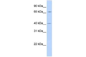 WB Suggested Anti-CCDC138 Antibody Titration: 0. (CCDC138 Antikörper  (N-Term))
