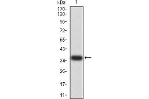 Western blot analysis using PRKAA2 mAb against human *** (AA: 453-552) recombinant protein. (PRKAA2 Antikörper  (AA 453-552))
