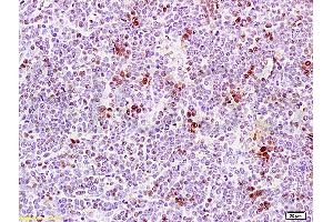 Formalin-fixed and paraffin embedded rat thymus tissue labeled Anti-PCNA Polyclonal Antibody, Unconjugated (ABIN672756) at 1:200, followed by conjugation to the secondary antibody and DAB staining (PCNA Antikörper  (AA 185-261))