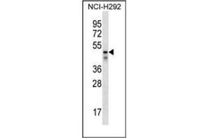 Western blot analysis of PDZK1 Antibody (Center) in NCI-H292 cell line lysates (35ug/lane). (PDZK1 Antikörper  (Middle Region))