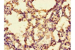 Immunohistochemistry of paraffin-embedded human lung tissue using ABIN7142675 at dilution of 1:100 (PRKAA1 Antikörper  (Catalytic Subunit alpha))